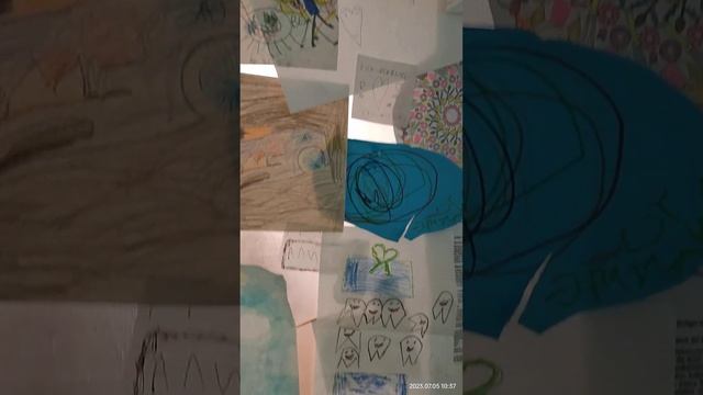 05/07/23 современная стоматология в Берлине с Youtube TV, наушниками. На стенах детские рисунки смотреть онлайн