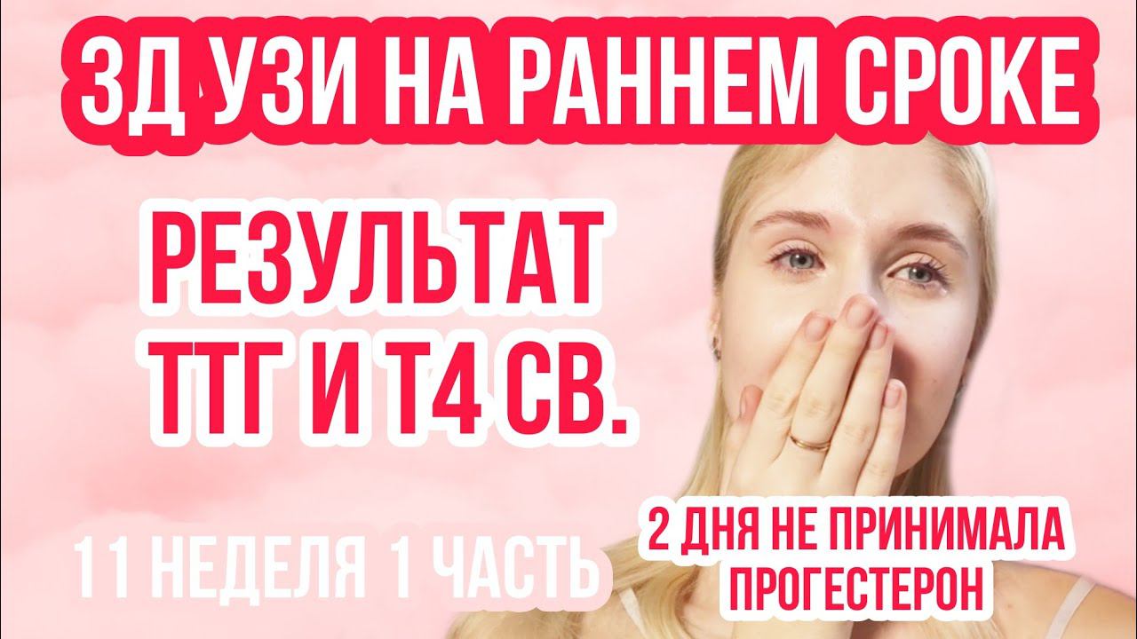 3Д УЗИ на раннем сроке ◈ СЕРДЦЕБИЕНИЕ ◈ТТГ и Т4◈11 неделя беременности 1Часть◈Влоги беременной Сашки смотреть онлайн