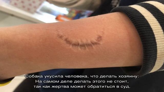 Если собака укусила человека, что грозит хозяину? Что хозяину делать с укусившей человека собакой? смотреть онлайн