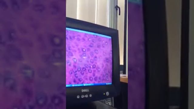 Revisão Patologia Monitor - video 40 смотреть онлайн
