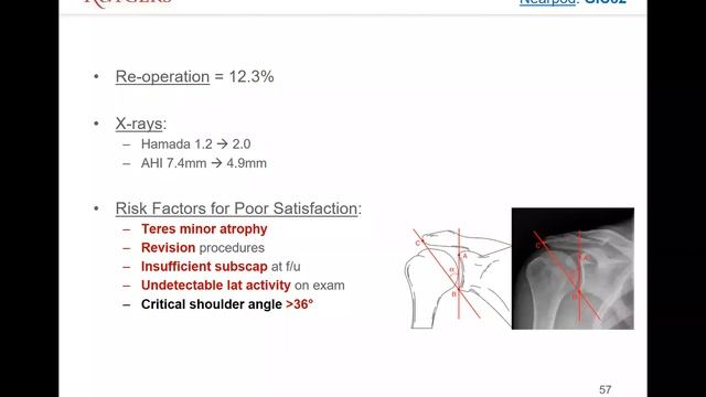 Todd Alter, MD - Massive Irreparable Rotator Cuff Tears смотреть онлайн