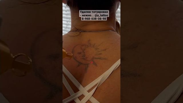 Сладко стонет / Удаление татуировок лазером / #юрецудалец #татуировка #удалениетатулазером смотреть онлайн