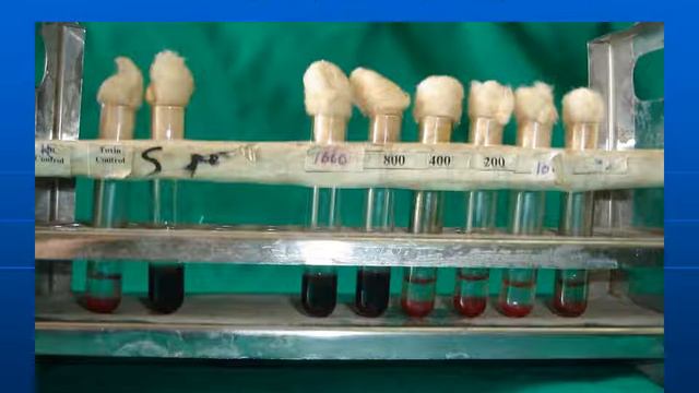 Strep سكشن ١٠ ميكرو الجزء الأول смотреть онлайн