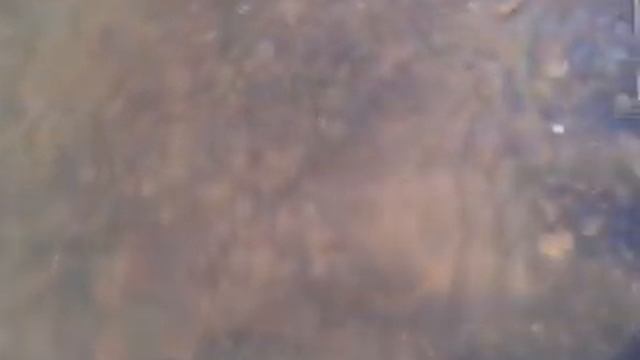 Усть-илимск биоэнергетика. Причины болезней. смотреть онлайн