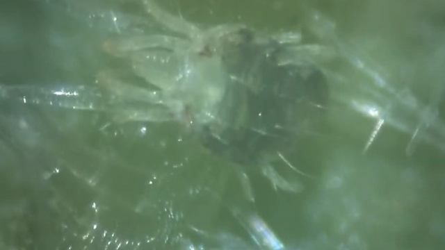 Обыкновенный паутинный клещ (лат. Tetranychus urticae) под микроскопом смотреть онлайн