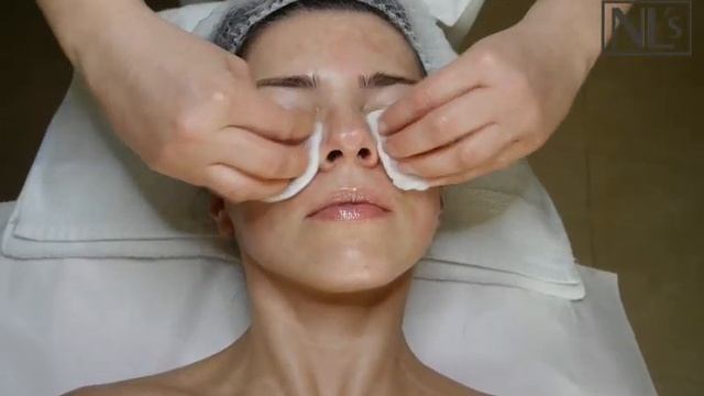Peeling kwasem TCA - wskazania, przebieg i efekty peelingu chemicznego смотреть онлайн