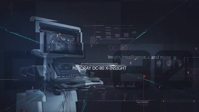 УЗИ аппарат Mindray DC-80 X-insight смотреть онлайн