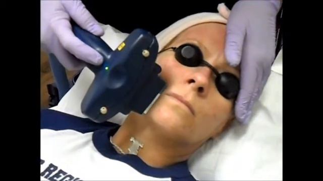 Pure Image Laser and Spa IPL Fotofacial Treatement смотреть онлайн