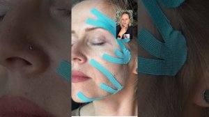 Мифы и ошибки в тейпировании Прямой эфир