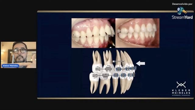 Kleber Meireles: Доступная и практически применимая Биомеханика смотреть онлайн