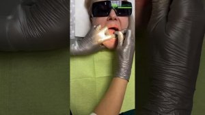 Имплантация зубов All-on-6 - всё на шести имплантатах в Сочи