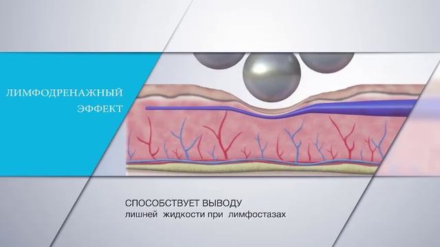 Аппарат Эндосфера представлен в Clinic&spa Zолотой. смотреть онлайн
