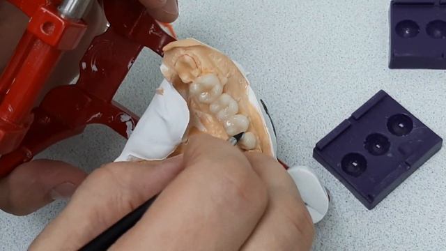 Работа с временными реставрациями смотреть онлайн