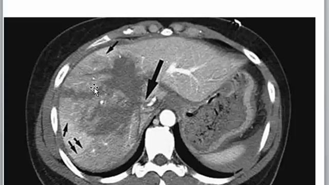 GIT 6 Trauma смотреть онлайн