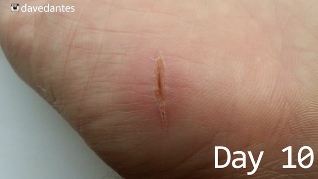 Как заживает порез на руке. Съёмки шли около двух месяцев. смотреть онлайн