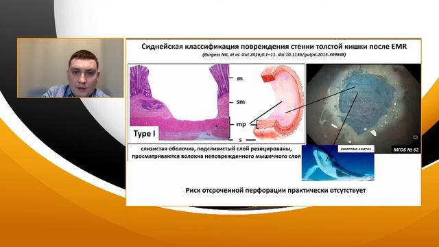 2. Соколов СА. Отсроченные перфорации стенки толстой кишки после резекций слизистой. Анализ факторо смотреть онлайн