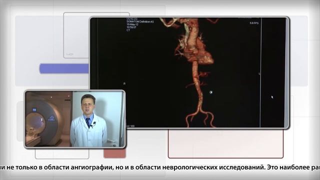 Компьютерная томография 3 смотреть онлайн