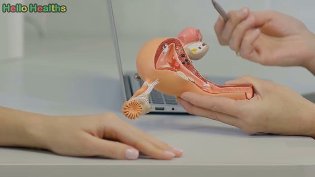 পিরিয়ড দেরীতে হওয়ার ৭টি বিশেষ কারণ । 7 Reasons for Missed or Irregular Periods in Bangla смотреть онлайн