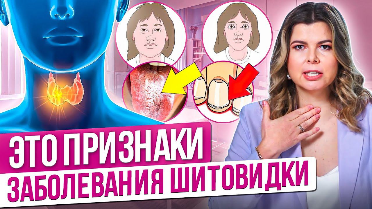 Щитовидная железа, симптомы заболевания. Проблемы с щитовидкой. Заболевания щитовидной железы. смотреть онлайн