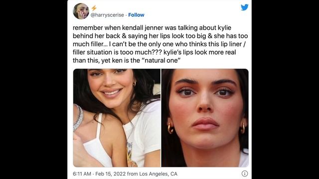 Wtf Happened To Kendall Jenner's Face...?!