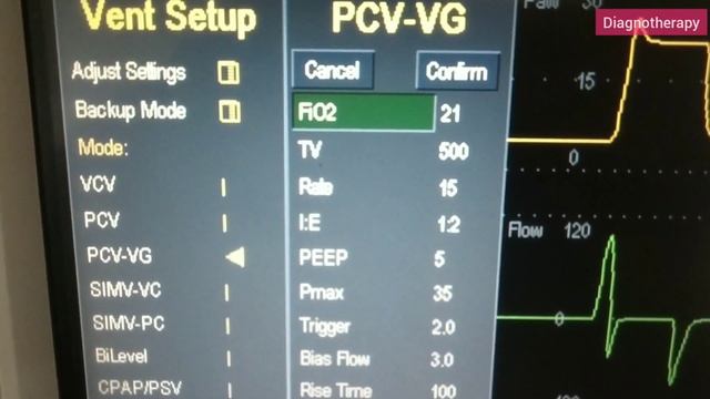 PCV VG | Pressure Control Ventilation - Volume Guarantee | Ventilation Mode смотреть онлайн