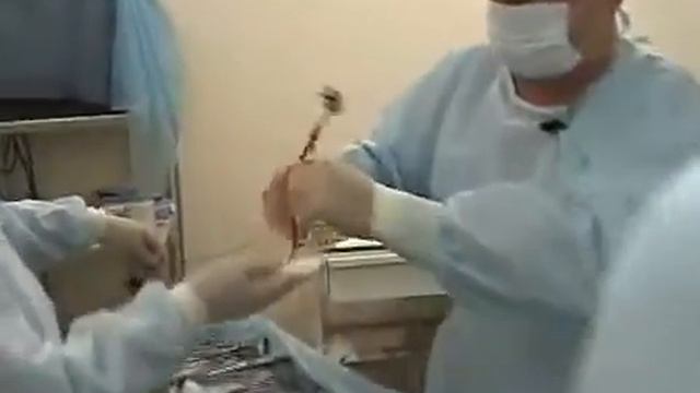 Венэктомия смотреть онлайн