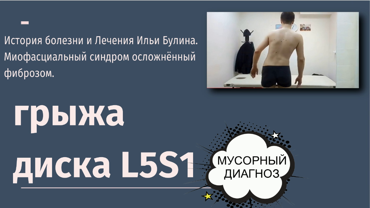 Грыжа диска L5S1. МФС. История болезни и лечения Ильи Булина.