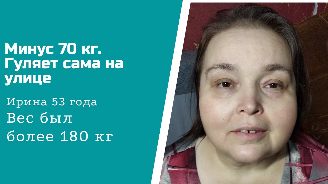 Минус 70 кг. Ирина сама гуляет на улице.mp4 смотреть онлайн