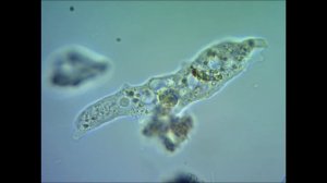 Амеба под микроскопом ameba under microscope
