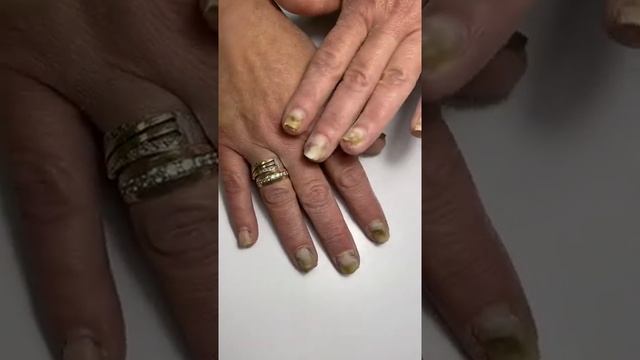 Зелень под ногтями смотреть онлайн