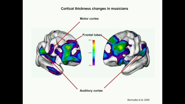 From Perception to Pleasure: How Music Changes the Brain | Dr. Robert Zatorre | TEDxHECMontréal смотреть онлайн