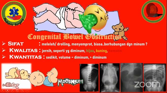 Emergency In Pediatric Surgery