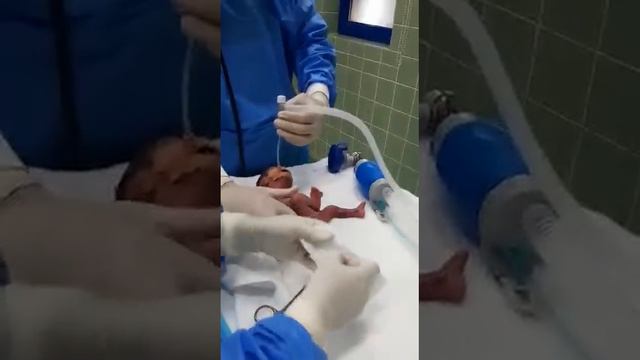 Workshop 29 preterm 27 weeks, RDS , STABILIZATION of baby in delivery room, practical tips смотреть онлайн