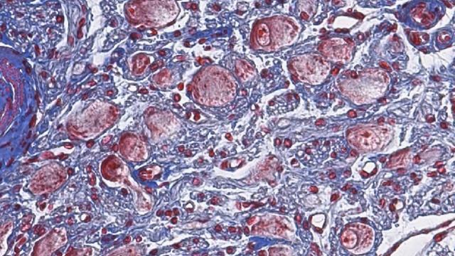 Симпатический ганглий