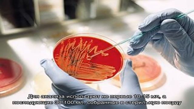 Микробиологический анализ мочи смотреть онлайн
