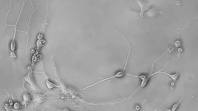 Etaluma and ALVEOLE, neurons migrating on laminin patterns смотреть онлайн