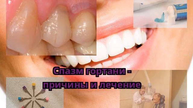 Спазм гортани - причины и лечение смотреть онлайн
