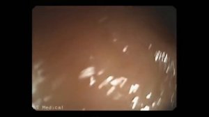 20 САМЫХ МАЛЕНЬКИХ ВЕЩЕЙ В МИРЕ