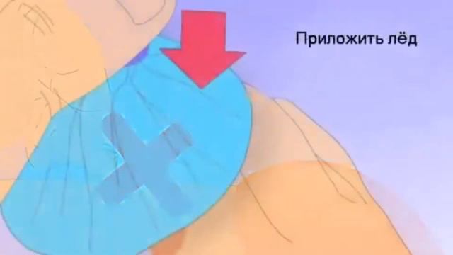 Детский травматизм смотреть онлайн