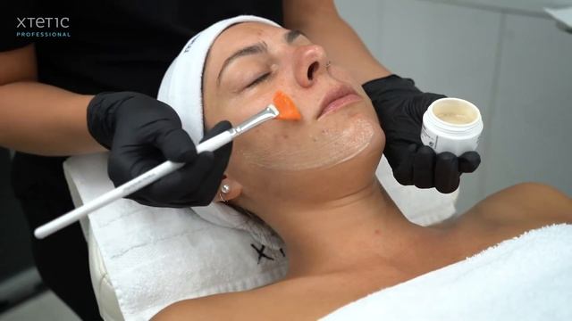 Acnelan Pack Promotional Video