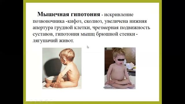 АФО мышц смотреть онлайн