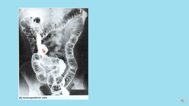Radiographs part - 4 of 4 смотреть онлайн