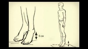 Виброгимнастика академика Микулина: секрет активного долголетия!