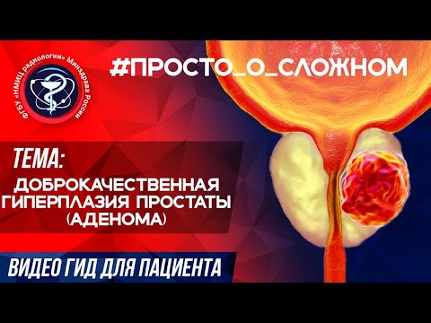 #ПРОСТО_о_СЛОЖНОМ Доброкачественная гиперплазия простаты (аденома). смотреть онлайн