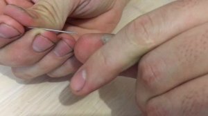 Пузырь от ожога