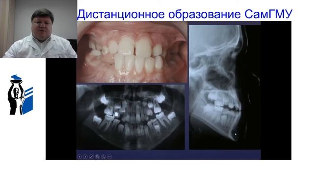 Современный подход к лечению сагитальных аномалий окклюзии. смотреть онлайн
