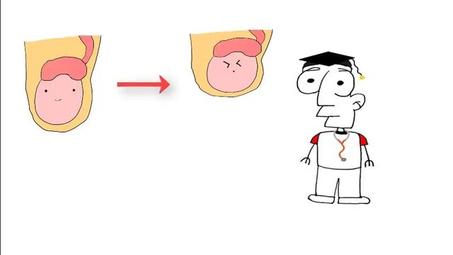 Why do testicles move up and down. смотреть онлайн