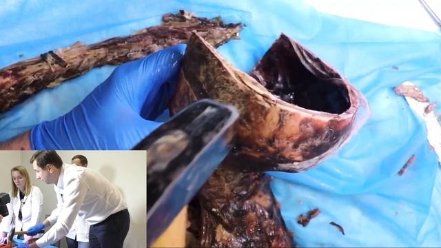 Оцениваем подвижность костей черепа смотреть онлайн