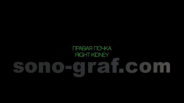 УЗИ - киста почки смотреть онлайн