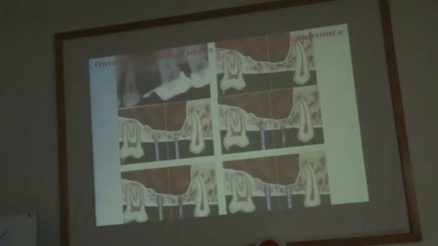 Клиническая пародонтология. Лекция 4 смотреть онлайн